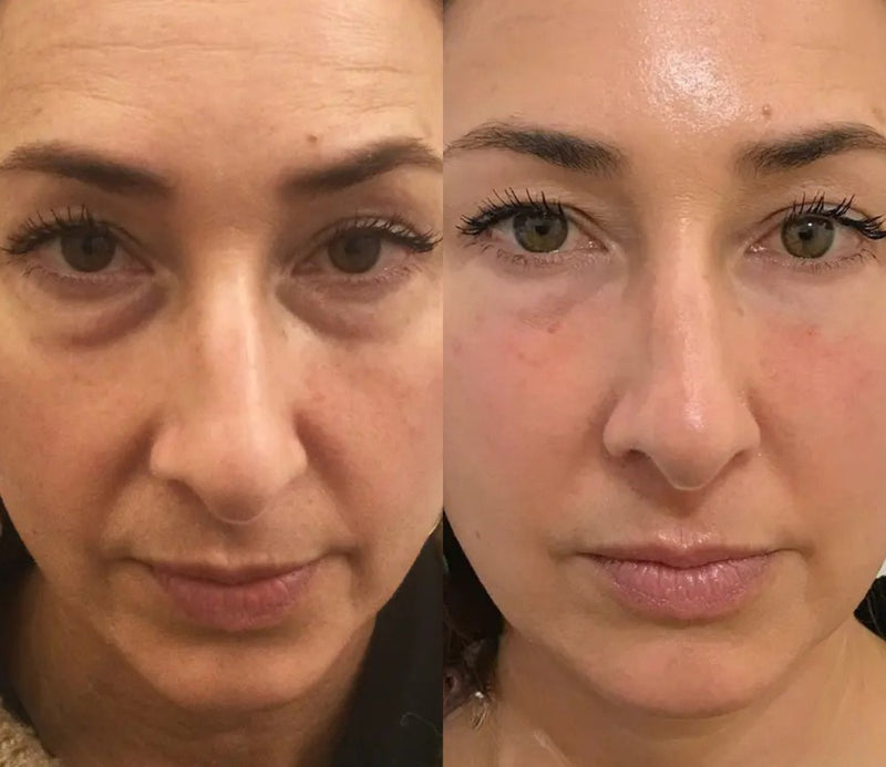 Fabienne, 50